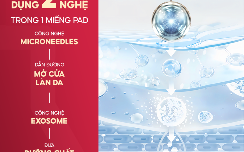 pad-exosome-3 - Copy
